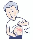 帯状疱疹に罹った人のイメージイラスト