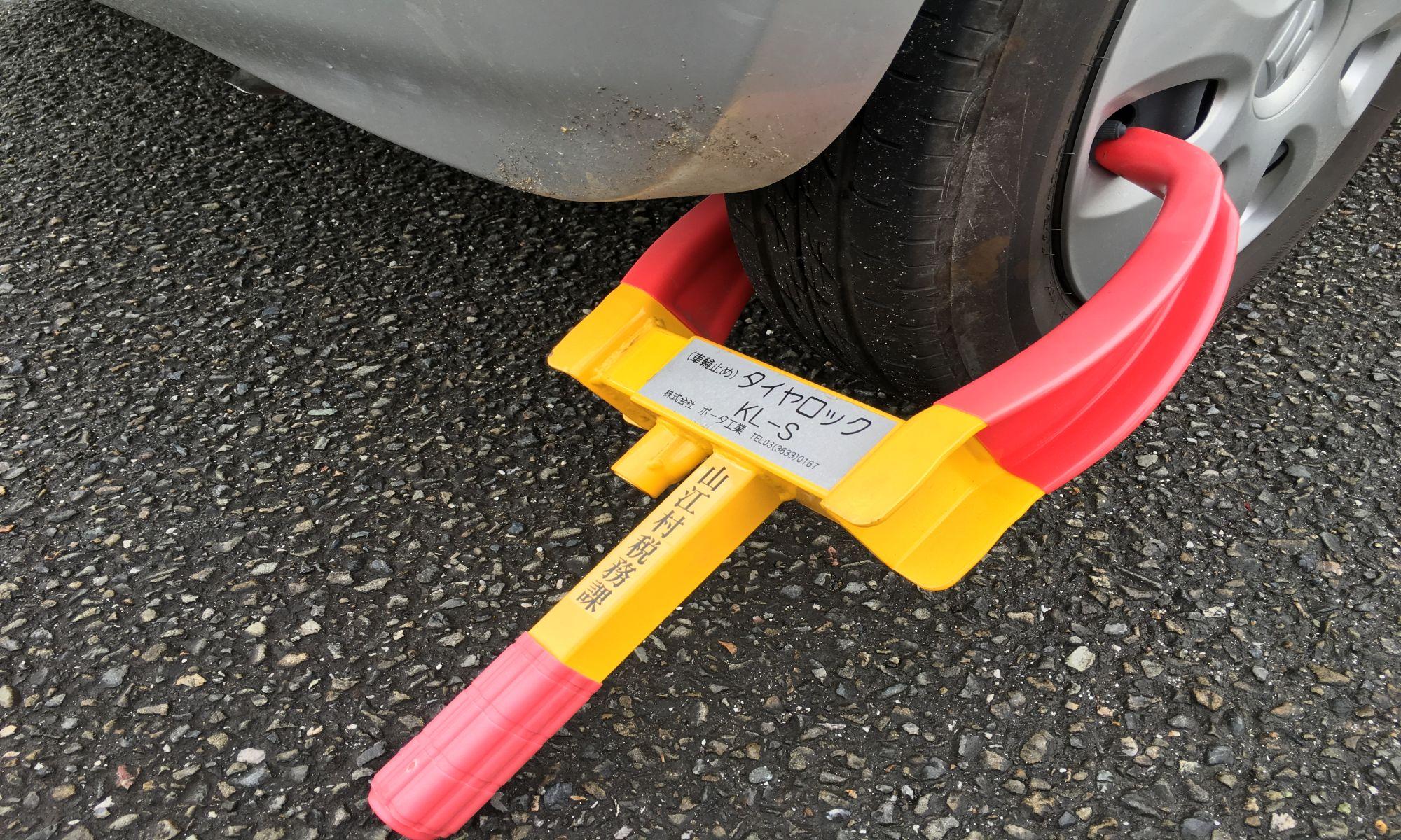 自動車のタイヤロックの写真